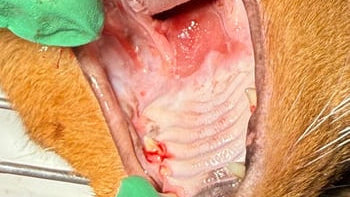 Dental